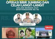 HUT Bhayangkara ke-78 Polda Bakti Sosial Operasi Bibir Sumbing